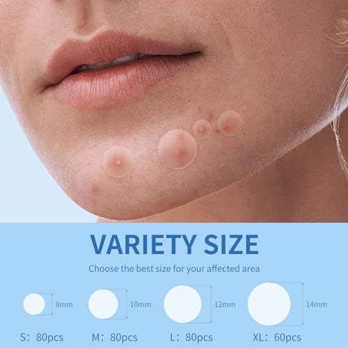 Daolyo Pimple Patches for Face, 4 Size 300 Counts Acne Patches, Hydrocolloid Patches for Covering Zits and Blemishes, Spot Stickers with Salicylic Acid, Tea Tree Oil & Calendula Oil - Image 3